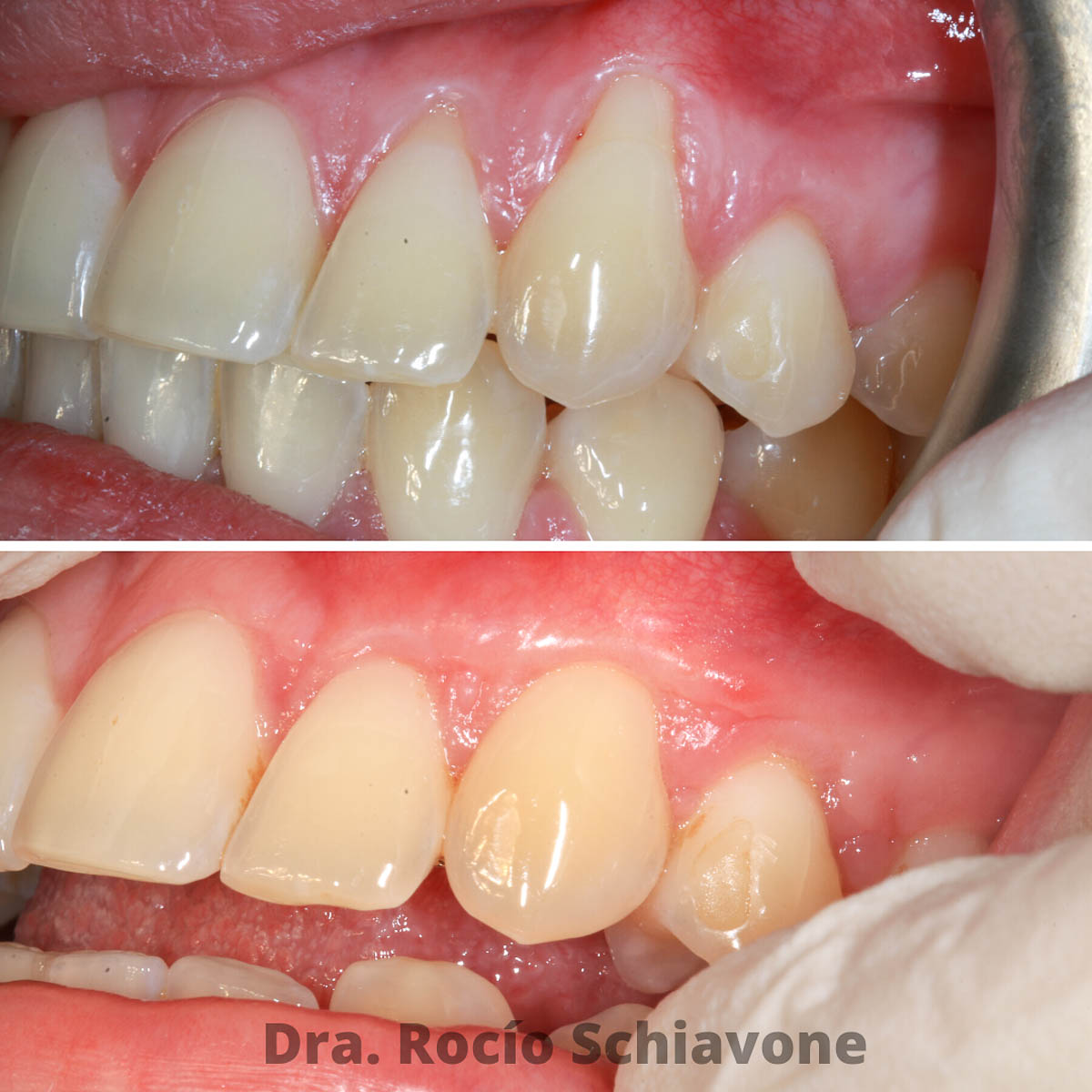 Cirugia Periodontal Custom Dental