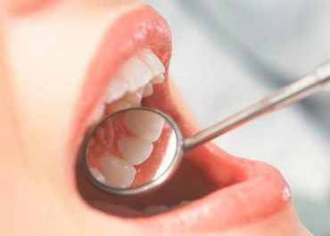 10 Preguntas Frecuentes al Dentista