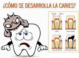 Cómo prevenir la caries dental