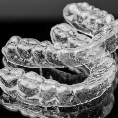 15 Preguntas Frecuentes Sobre Ortodoncia Invisible