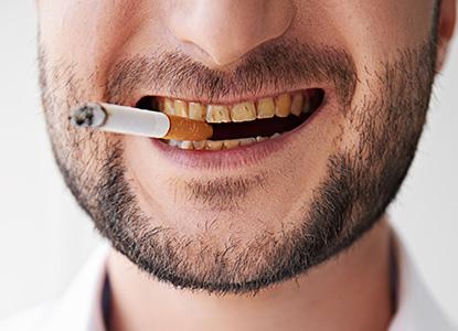 El consumo habitual de tabaco daña dientes y encías