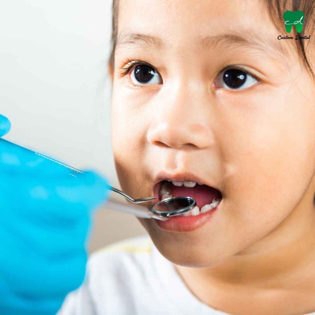 Cuidado bucal en niños.
Visitas periódicas al especialista.