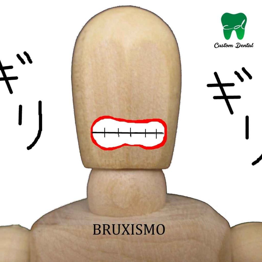 Bruxismo