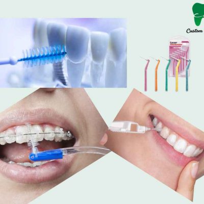 Cepillos interproximales o interdentales
